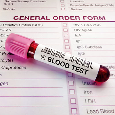 sandpoint-blood-testing-collection-site